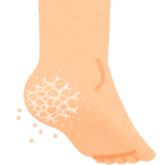 【方言】「あくど（あぐど）」の意味と例文